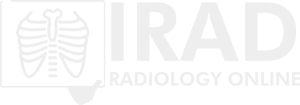 iRad